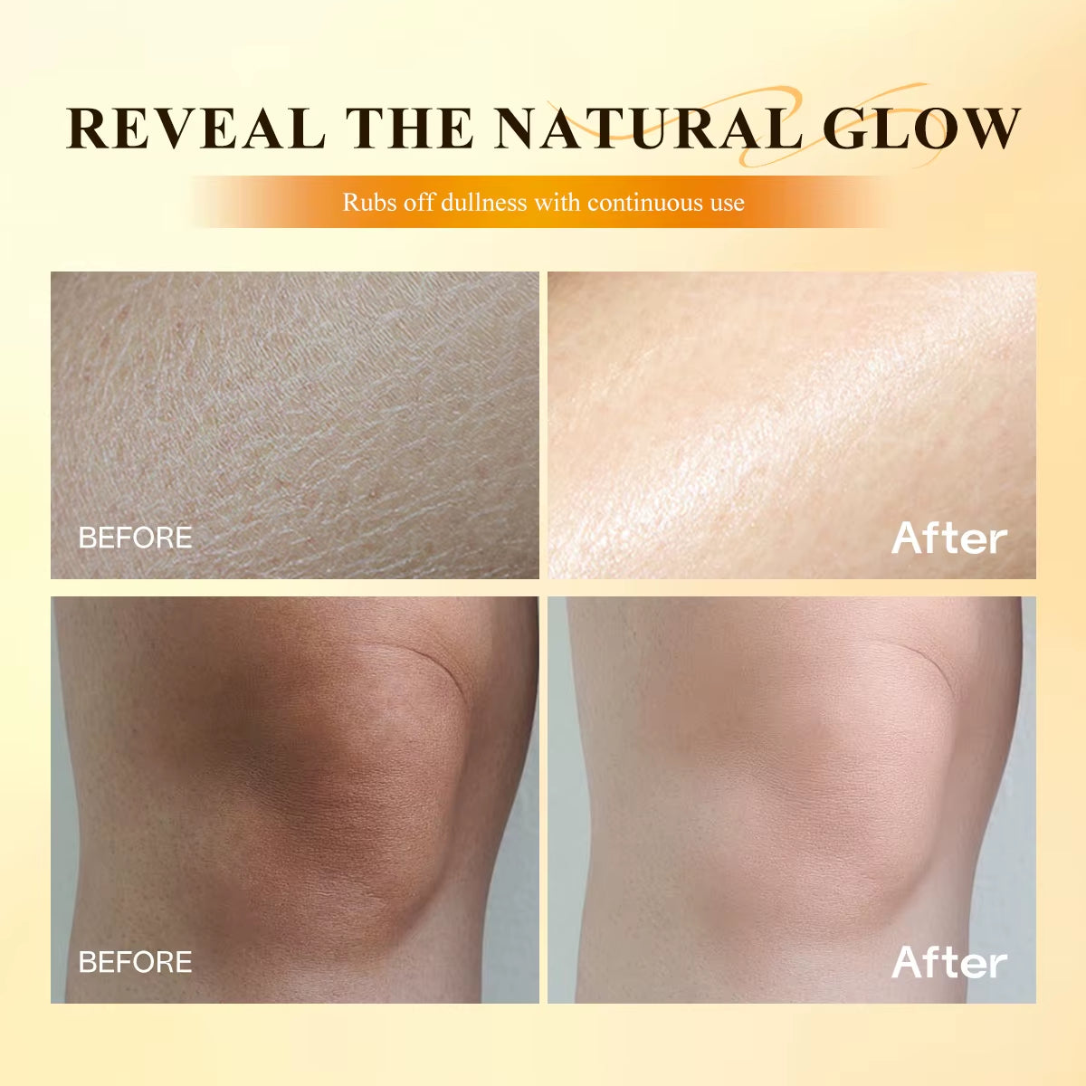 Gently Exfoliating Peeling Solution Body Keratin Care Kojic Acid Turmeric Spray for All Skin Types